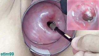 Mature Milf Cervix Duplicate fool around with Endoscope Japanese Cam into Uterus